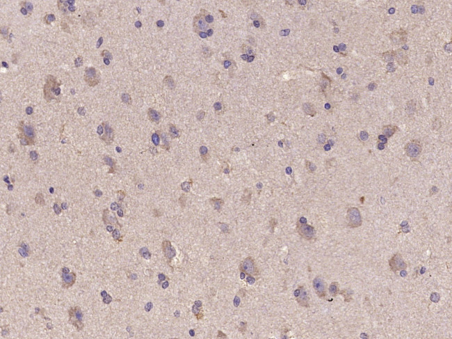IDH1 Antibody in Immunohistochemistry (Paraffin) (IHC (P))