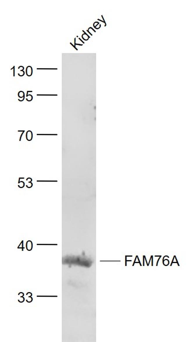 FAM76A Antibody in Western Blot (WB)