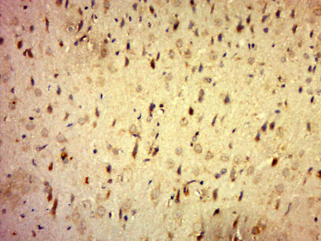 C20orf196 Antibody in Immunohistochemistry (Paraffin) (IHC (P))