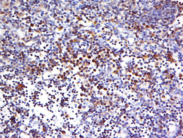 HECA Antibody in Immunohistochemistry (Paraffin) (IHC (P))