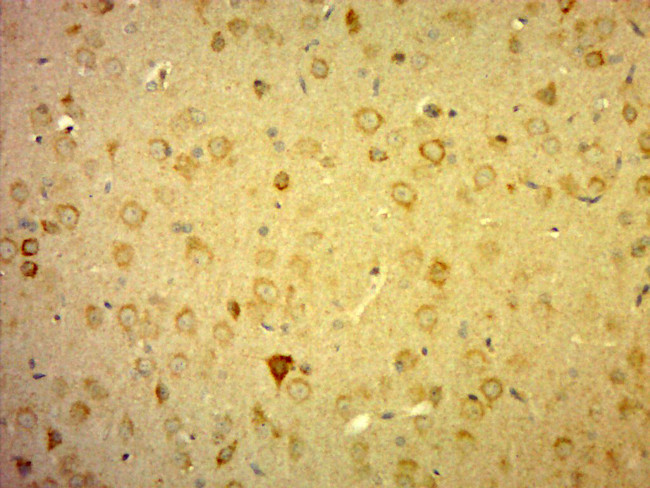 C10orf27 Antibody in Immunohistochemistry (Paraffin) (IHC (P))