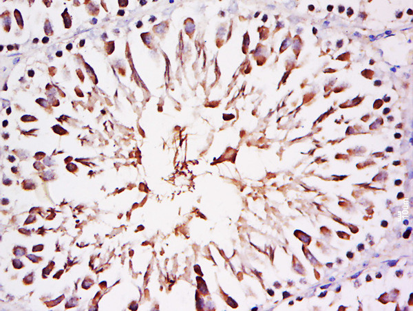 FAM29A Antibody in Immunohistochemistry (Paraffin) (IHC (P))