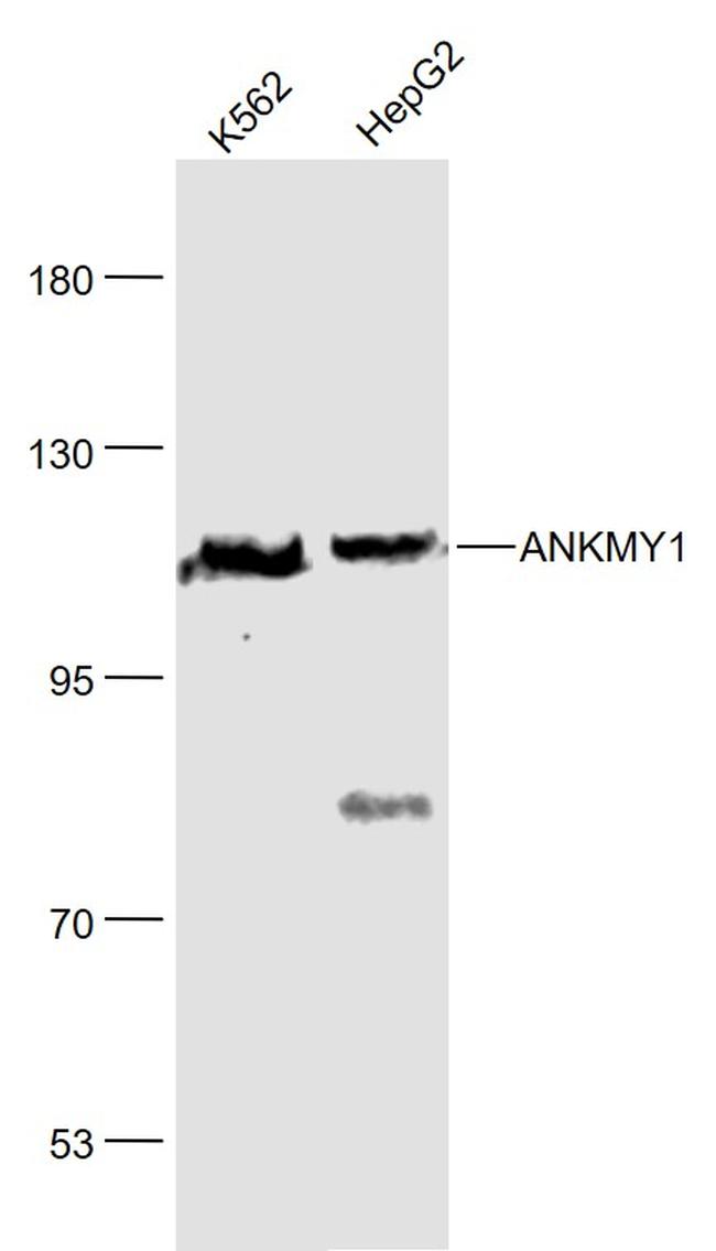 ANKMY1 Antibody in Western Blot (WB)