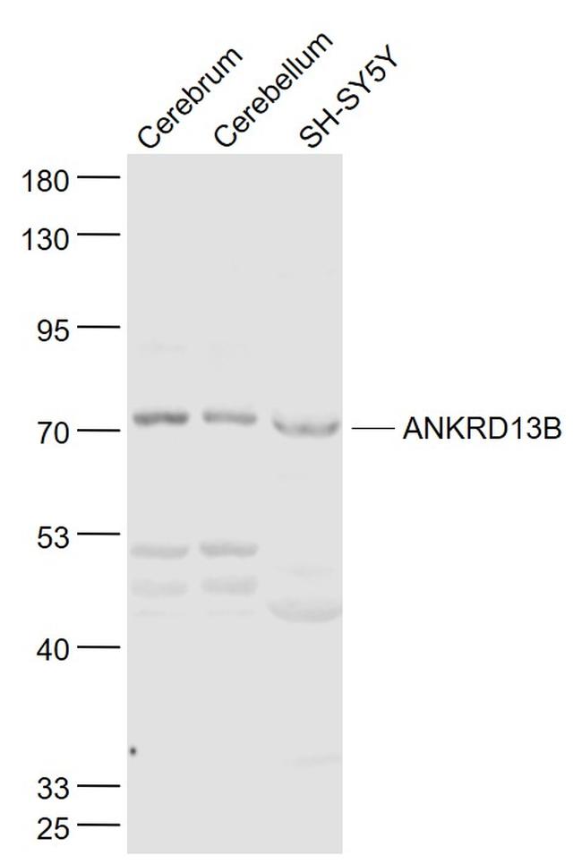 ANKRD13B Antibody in Western Blot (WB)
