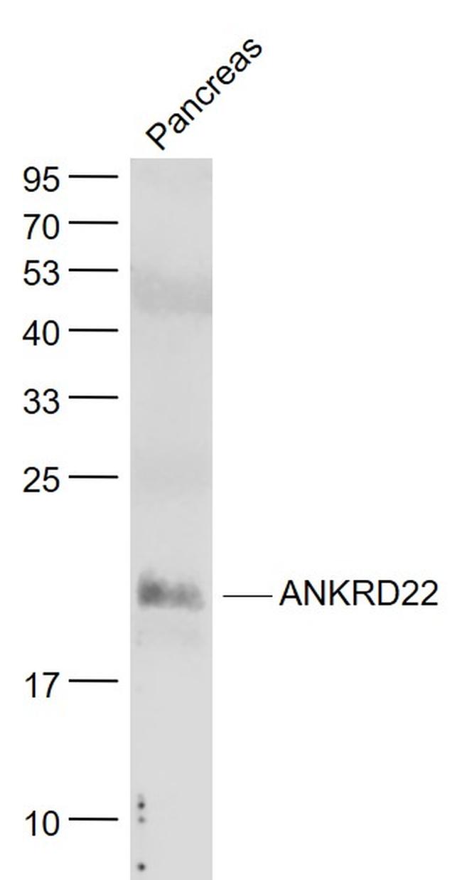 ANKRD22 Antibody in Western Blot (WB)