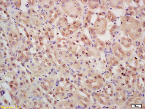 INTS3 Antibody in Immunohistochemistry (Paraffin) (IHC (P))