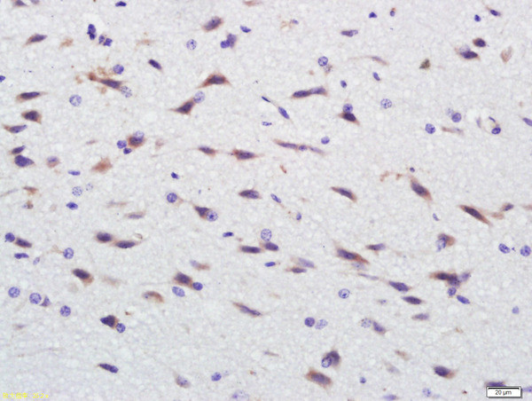 EGFR5 Antibody in Immunohistochemistry (Paraffin) (IHC (P))