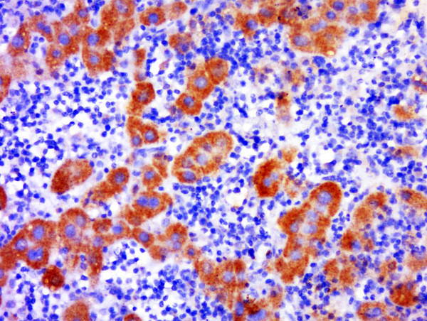 C2orf44 Antibody in Immunohistochemistry (Paraffin) (IHC (P))