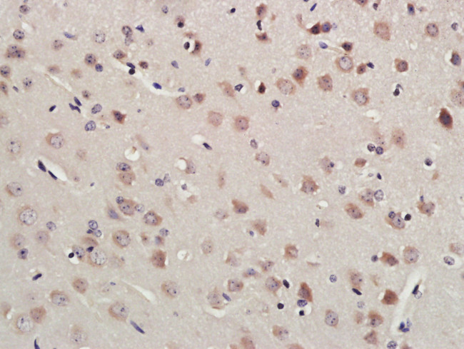 RNF213 Antibody in Immunohistochemistry (Paraffin) (IHC (P))