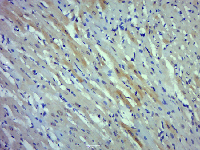 Phospho-cardiac Troponin I (Thr143) Antibody in Immunohistochemistry (Paraffin) (IHC (P))