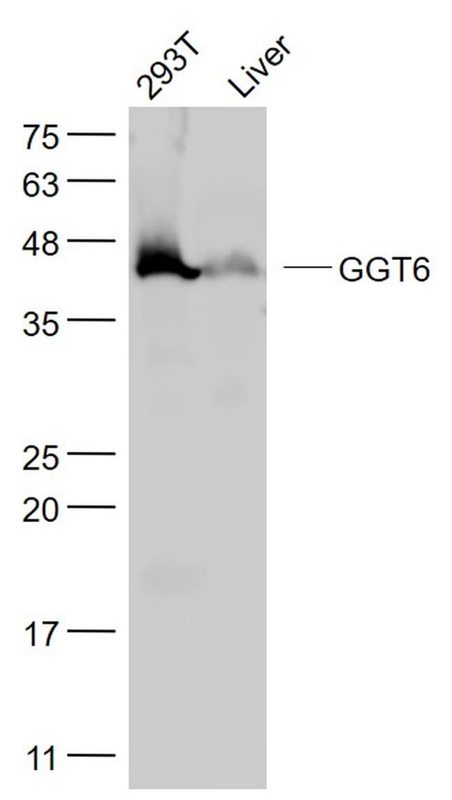 GGT6 Antibody in Western Blot (WB)