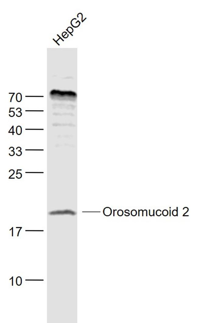 Orosomucoid 2 Antibody in Western Blot (WB)