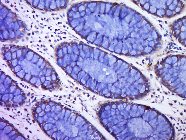 C12ORF42 Antibody in Immunohistochemistry (Paraffin) (IHC (P))