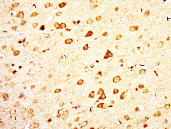 C12ORF68 Antibody in Immunohistochemistry (Paraffin) (IHC (P))