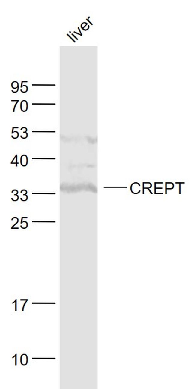 CREPT Antibody in Western Blot (WB)