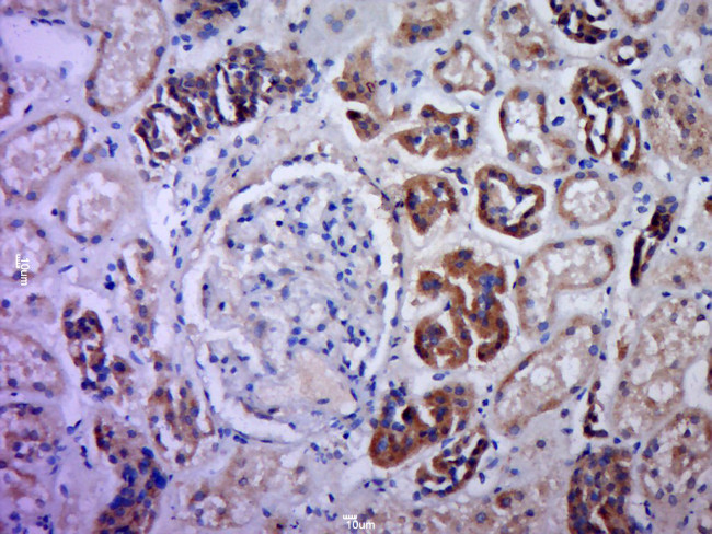C21orf70 Antibody in Immunohistochemistry (Paraffin) (IHC (P))