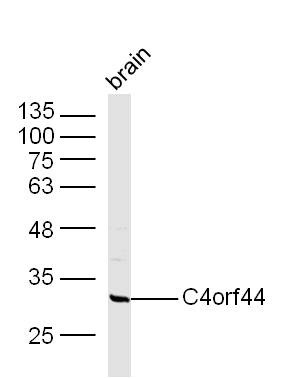 C4orf44 Antibody in Immunohistochemistry (Paraffin) (IHC (P))