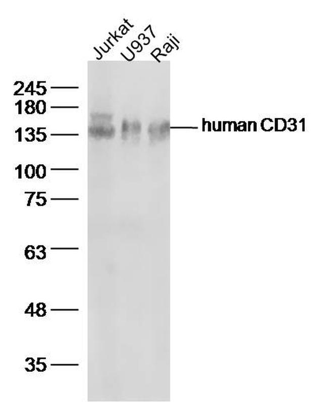 CD31 Antibody in Western Blot (WB)