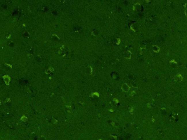 TIMP-1 Antibody in Immunohistochemistry (Paraffin) (IHC (P))