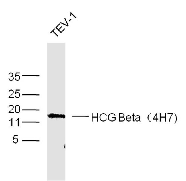 HCG Beta Antibody in Western Blot (WB)