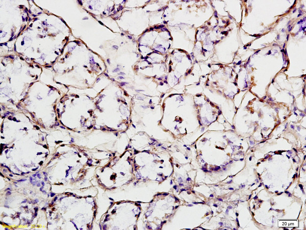 HER2 receptor Antibody in Immunohistochemistry (Paraffin) (IHC (P))