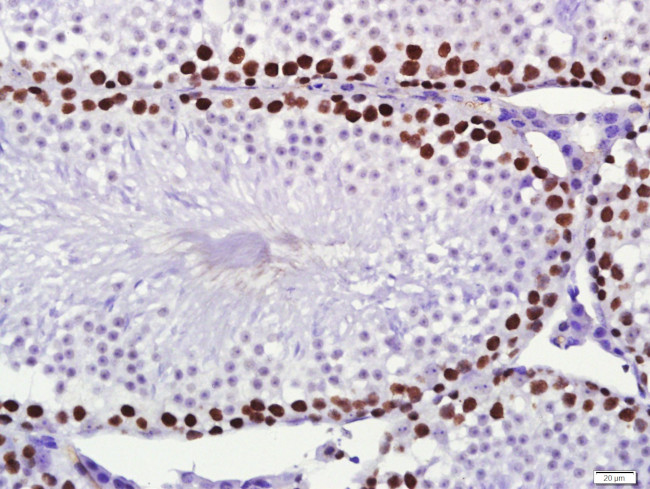PCNA Antibody in Immunohistochemistry (Paraffin) (IHC (P))