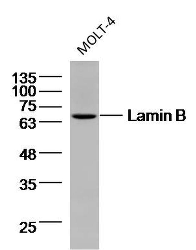 Lamin B Antibody in Western Blot (WB)