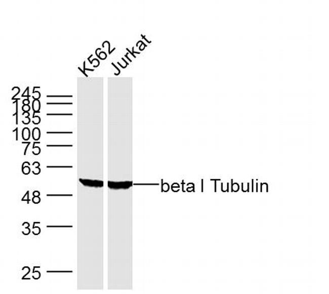 beta 1 Tubulin Antibody in Western Blot (WB)