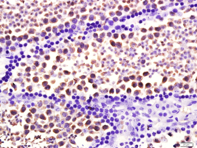 HSP70 Antibody in Immunohistochemistry (Paraffin) (IHC (P))