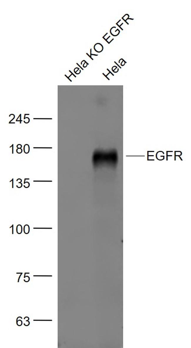 EGFR Antibody in Western Blot (WB)