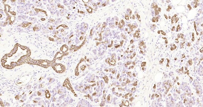 CK7 Antibody in Immunohistochemistry (Paraffin) (IHC (P))