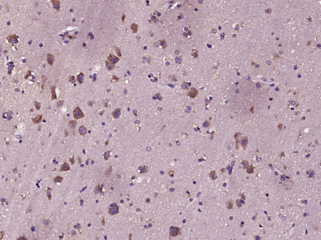 C-erbB-2/HER2 Antibody in Immunohistochemistry (Paraffin) (IHC (P))