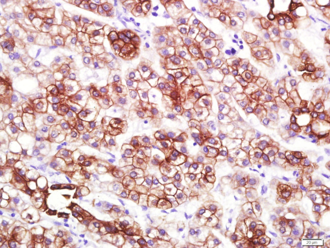 KRT18 Antibody in Immunohistochemistry (Paraffin) (IHC (P))