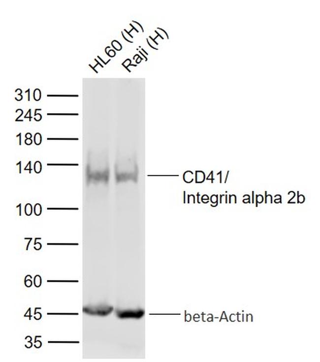 CD41/Integrin alpha 2b Antibody in Western Blot (WB)