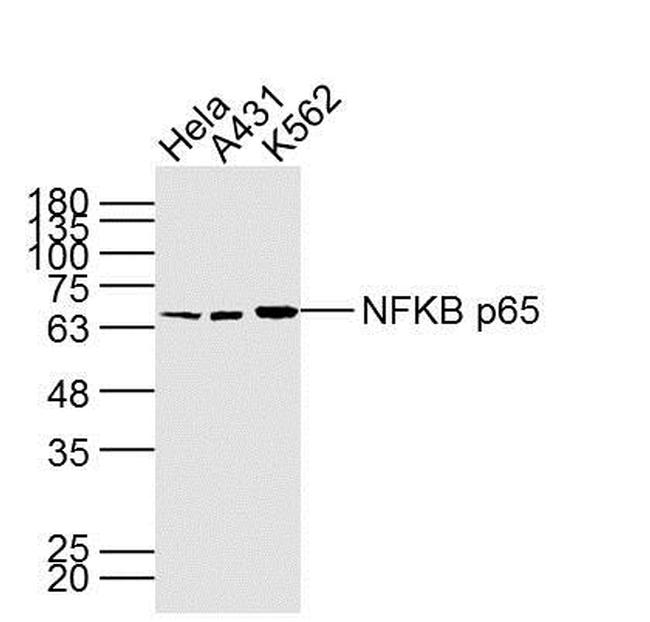 NFKB p65 Antibody in Western Blot (WB)