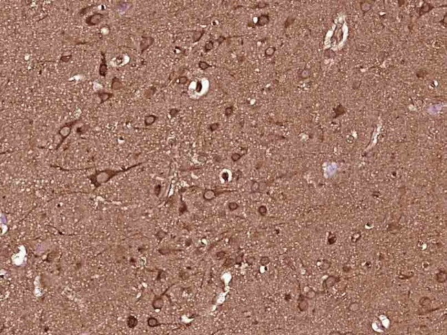 MEK2 Antibody in Immunohistochemistry (Paraffin) (IHC (P))