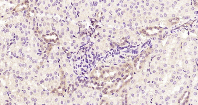STAT3 Antibody in Immunohistochemistry (Paraffin) (IHC (P))