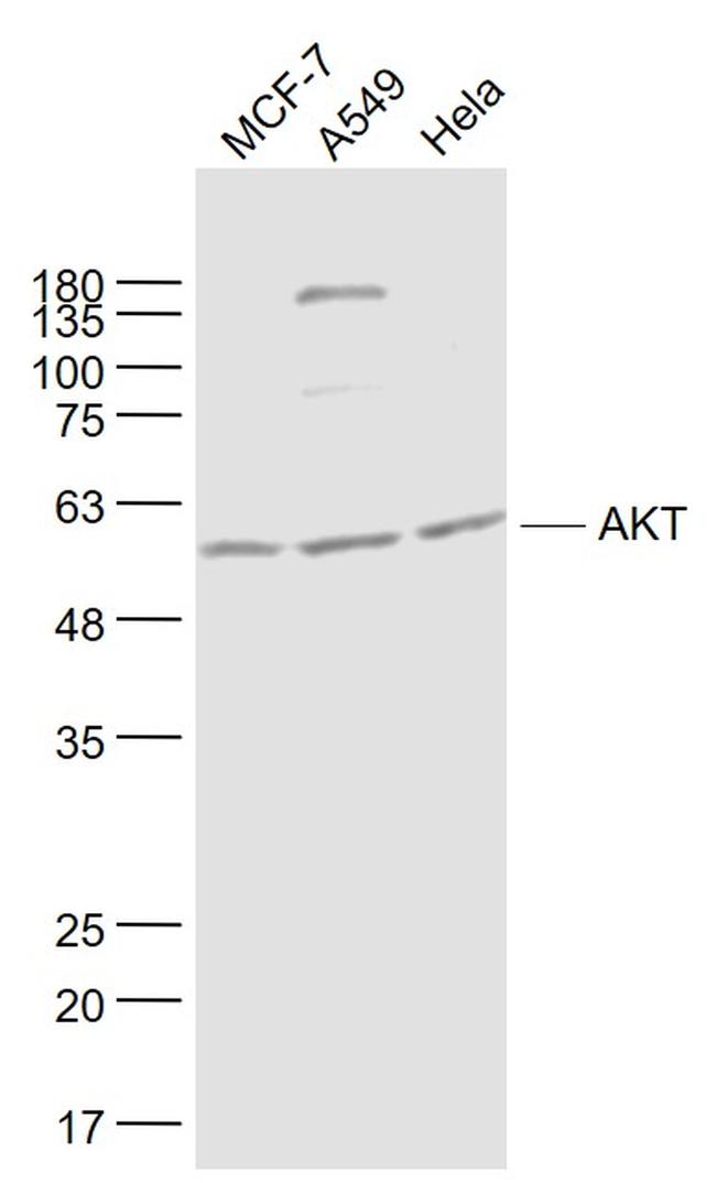 AKT Antibody in Western Blot (WB)