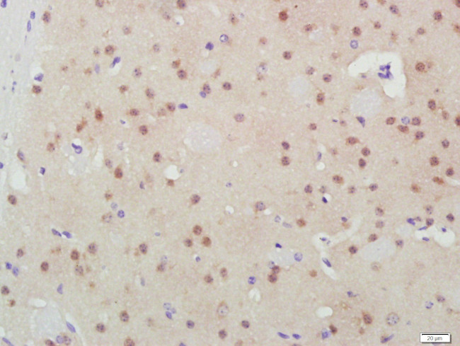 GSK3B Antibody in Immunohistochemistry (Paraffin) (IHC (P))