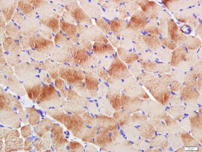 Actin, alpha skeletal muscle Antibody in Immunohistochemistry (Paraffin) (IHC (P))