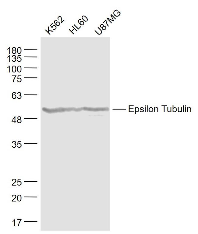 Epsilon Tubulin Antibody in Western Blot (WB)