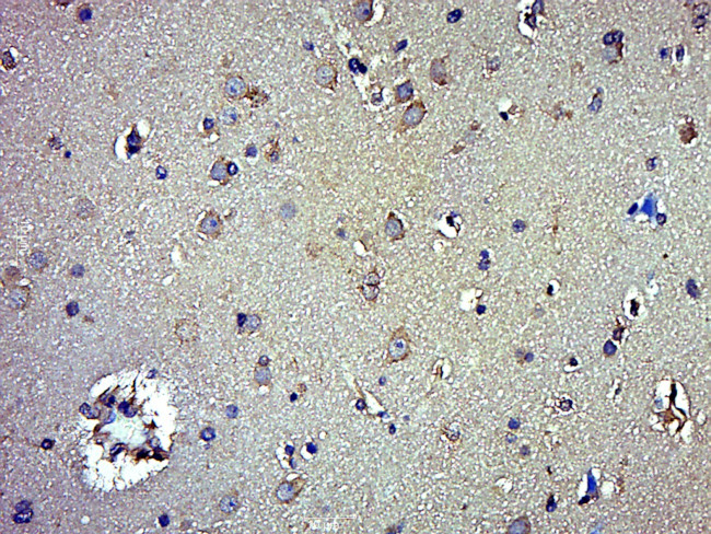 Beclin 1 Antibody in Immunohistochemistry (Paraffin) (IHC (P))