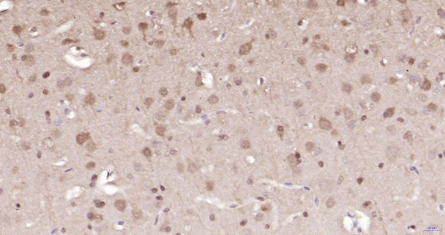 ERK1/2 Antibody in Immunohistochemistry (Paraffin) (IHC (P))