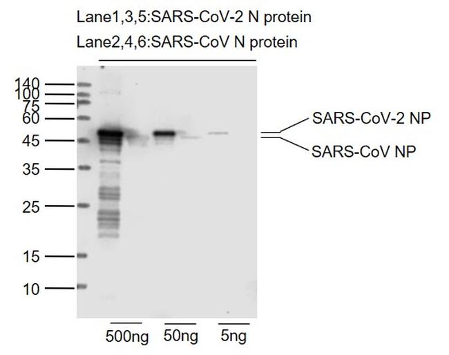 SARS-CoV-2 Nucleocapsid protein Antibody in Western Blot (WB)