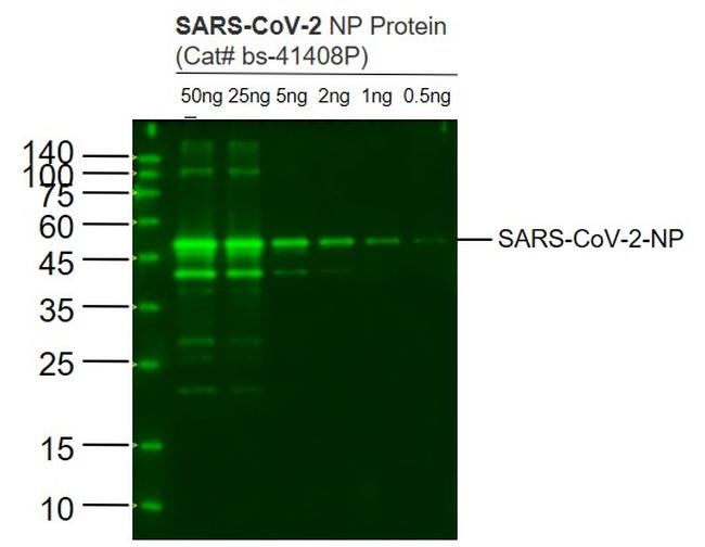 SARS-CoV-2 Nucleocapsid Protein Antibody in Western Blot (WB)