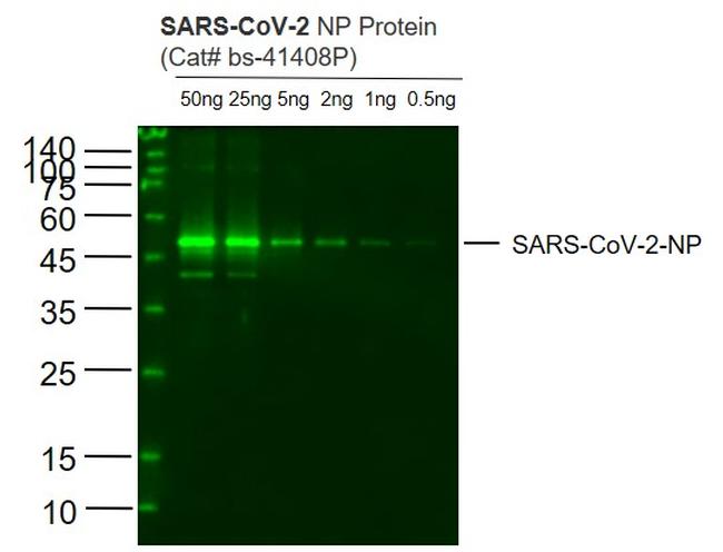 SARS-CoV-2 Nucleocapsid Protein Antibody in Western Blot (WB)