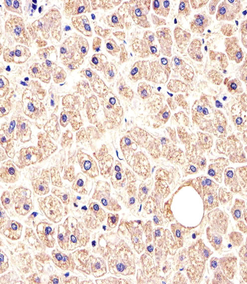 MET/HGFR Antibody in Immunohistochemistry (Paraffin) (IHC (P))
