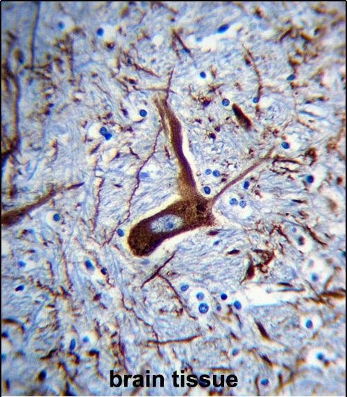 MAP2 Antibody in Immunohistochemistry (Paraffin) (IHC (P))