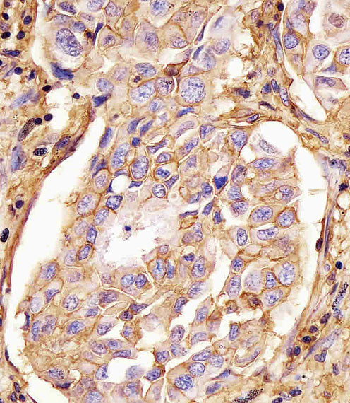 CD44 Antibody in Immunohistochemistry (Paraffin) (IHC (P))
