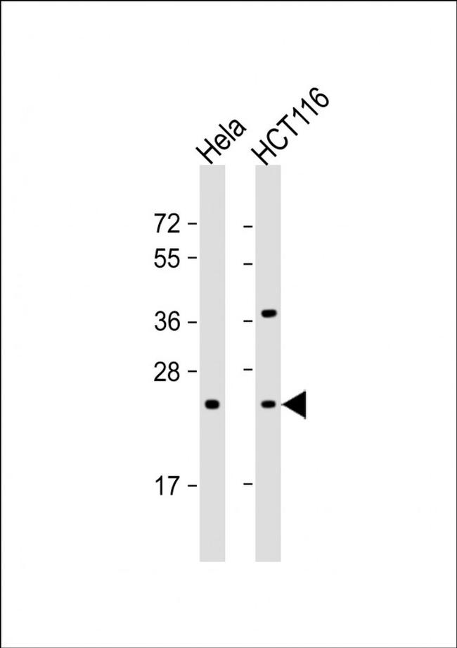 RAB8A Antibody in Western Blot (WB)
